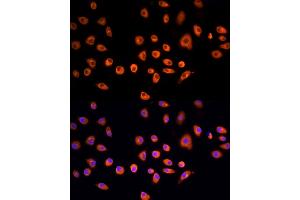 Immunofluorescence (IF) image for anti-Epidermal Growth Factor Receptor Pathway Substrate 15 (EPS15) (AA 660-840) antibody (ABIN6140236)