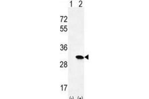 Western Blotting (WB) image for anti-HRas proto-oncogene, GTPase (HRAS) antibody (ABIN2996311) (HRAS 抗体)