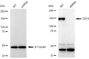 Western blotting analysis using CD13 antibody (ABIN7797548). (Recombinant CD13 抗体)