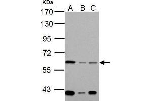 Western Blotting (WB) image for anti-NADPH Oxidase 1 (NOX1) antibody (ABIN2855720)