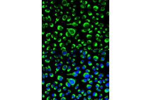 Immunofluorescence analysis of HeLa cells using P4HB antibody. (P4HB 抗体)