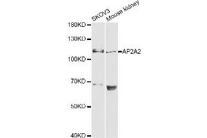 Western blot analysis of extracts of various cell lines, using AP2A2 antibody (ABIN6292468) at 1:1000 dilution. (AP2A2 抗体)