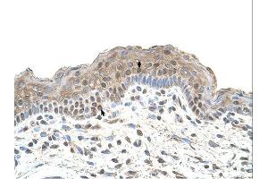 TAPBP antibody was used for immunohistochemistry at a concentration of 4-8 ug/ml.