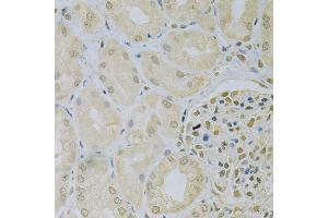 Immunohistochemistry of paraffin-embedded human kidney using CAMK1D Antibody (ABIN5975586) at dilution of 1/100 (40x lens). (CAMK1D 抗体)
