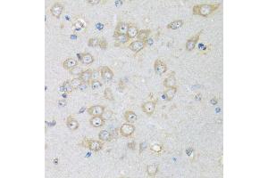 Immunohistochemistry of paraffin-embedded rat brain using CHMP1B antibody (ABIN5974811) at dilution of 1/100 (40x lens). (CHMP1B 抗体)