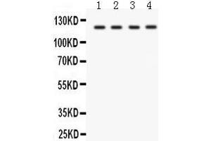 Western Blotting (WB) image for anti-Solute Carrier Family 12 (Sodium/potassium/chloride Transporters), Member 1 (SLC12A1) (AA 52-83), (N-Term) antibody (ABIN3043925)