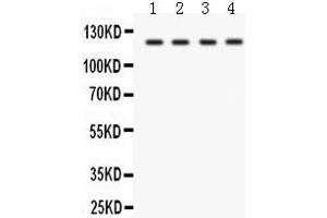 Anti- SLC12A1 Picoband antibody, Western blotting All lanes: Anti SLC12A1  at 0. (SLC12A1 抗体  (N-Term))
