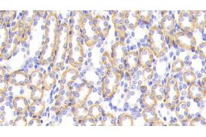Immunohistochemistry (IHC) image for anti-Cathepsin S (CTSS) (AA 123-339) antibody (ABIN7434371)