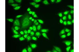 Immunofluorescence analysis of MCF-7 cells using RNF40 antibody. (RNF40 抗体)