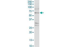 TJAP1 monoclonal antibody (M01), clone 2E5. (TJAP1 抗体  (AA 77-180))