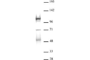 DNMT3B antibody (pAb) tested by Western blot. (DNMT3B 抗体  (AA 1-218))
