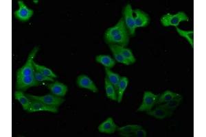 Immunofluorescence staining of HepG2 cells with ABIN7149404 at 1:100, counter-stained with DAPI. (PLA2G4B 抗体  (AA 514-781))