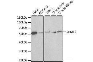 Western blot analysis of extracts of various cell lines using SHMT2 Polyclonal Antibody at dilution of 1:1000. (SHMT2 抗体)