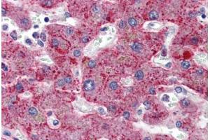 Human Liver: Formalin-Fixed, Paraffin-Embedded (FFPE) (SERPING1 抗体  (AA 1-501))