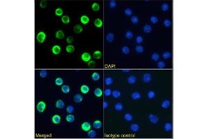 Immunofluorescence staining of mouse splenocytes using anti-CTLA-4 antibody 9D9. (Recombinant CTLA4 抗体)