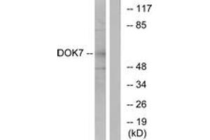 Western blot analysis of extracts from mouse brain cells, using DOK7 Antibody. (DOK7 抗体  (AA 10-59))