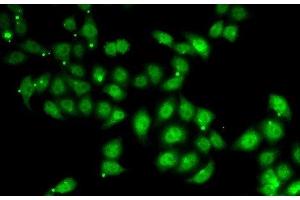 Immunofluorescence analysis of U2OS cells using AFF1 Polyclonal Antibody (AF4 抗体)