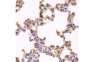 Immunohistochemistry of paraffin-embedded Rat lung using CASP3 antibody at dilution of 1:100 (x400 lens). (Caspase 3 抗体  (AA 100-200))
