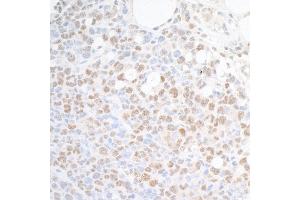 Immunohistochemistry (IHC) image for anti-Suppressor of Ty 6 Homolog (SUPT6H) (AA 425-475) antibody (ABIN7453850) (Spt6 抗体  (AA 425-475))