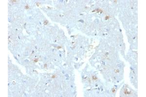 Formalin-fixed, paraffin-embedded human brain stained with UBE2C Mouse Monoclonal Antibody (CPTC-UBE2C-1) (UBE2C 抗体)