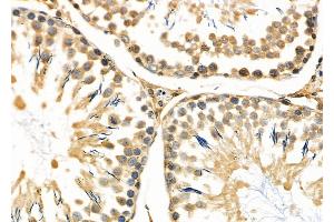 ABIN6263302 and ABIN6266595 at 1/100 staining Rat testis tissue by IHC-P. (Matrix Metallopeptidase 23 (MMP23) (C-Term) 抗体)