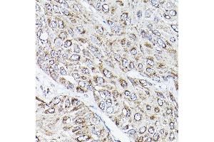 Immunohistochemistry (IHC) image for anti-Receptor (G Protein-Coupled) Activity Modifying Protein 2 (RAMP2) (AA 1-145) antibody (ABIN3017321)