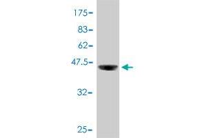 Western Blotting (WB) image for anti-Protein Kinase, CAMP-Dependent, Regulatory, Type I, alpha (Tissue Specific Extinguisher 1) (PRKAR1A) (AA 1-100) antibody (ABIN562373)