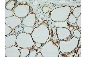 Immunohistochemical staining of paraffin-embedded Human thyroid tissue using anti-XPNPEP1 mouse monoclonal antibody. (XPNPEP1 抗体)