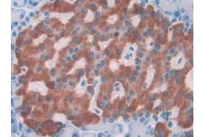 Detection of IL1a in Rat Pancreas Tissue using Monoclonal Antibody to Interleukin 1 Alpha (IL1a) (IL1A 抗体  (AA 115-270))