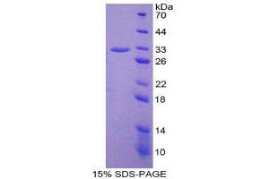 SDS-PAGE (SDS) image for Prostaglandin-Endoperoxide Synthase 2 (Prostaglandin G/H Synthase and Cyclooxygenase) (PTGS2) (AA 187-425) protein (His tag) (ABIN1878555)