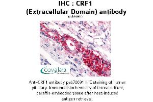 Image no. 1 for anti-Corticotropin Releasing Hormone Receptor 1 (CRHR1) (1st Extracellular Domain) antibody (ABIN1733303)