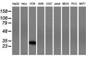 Western blot analysis of extracts (35 µg) from 9 different cell lines by using anti-FHL1 monoclonal antibody. (FHL1 抗体)