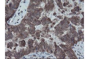 Image no. 7 for anti-SKI-Like Oncogene (SKIL) (AA 307-684) antibody (ABIN1491380)