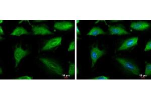 ICC/IF Image Aconitase 1 antibody [N1C1] detects Aconitase 1 protein at cytoplasm by immunofluorescent analysis. (Aconitase 1 抗体)