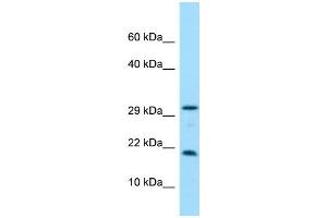 WB Suggested Anti-CRYGN Antibody Titration: 1. (CRYGN 抗体  (C-Term))