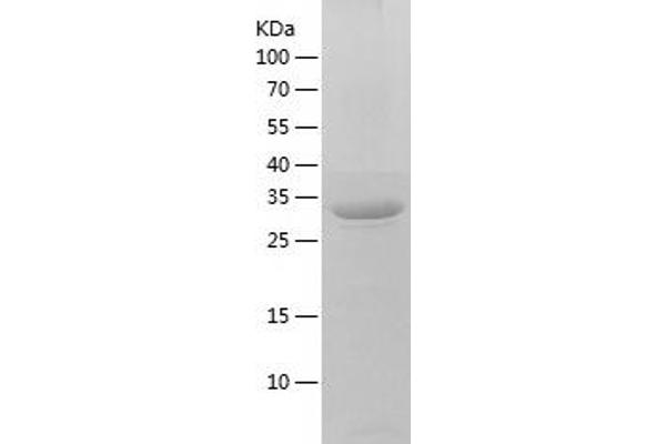 TATDN1 Protein (AA 1-297) (His tag)