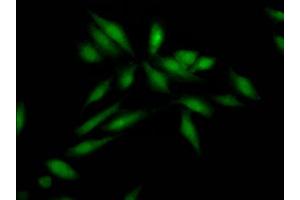 Immunofluorescence staining of Hela Cells with ABIN7127812 at 1:50, counter-stained with DAPI. (Recombinant SKP2 抗体)