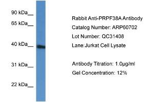 Western Blotting (WB) image for anti-PRP38 Pre-mRNA Processing Factor 38 (Yeast) Domain Containing A (PRPF38A) (C-Term) antibody (ABIN2774293)