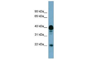 WB Suggested Anti-FAM45B Antibody Titration: 0. (FAM45B 抗体  (Middle Region))