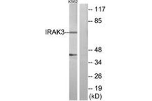 Western blot analysis of extracts from K562 cells, using IRAK3 Antibody.