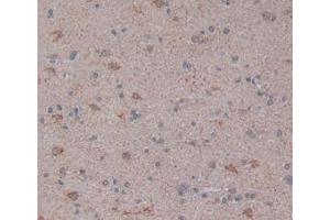 Figure. (LPCAT3 抗体  (AA 122-233))