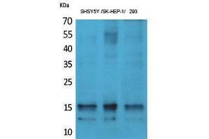 Western Blotting (WB) image for anti-Synuclein, alpha (SNCA) (pTyr125) antibody (ABIN3173525) (SNCA 抗体  (pTyr125))