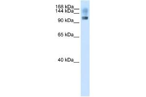 SFRS8 antibody used at 2. (SFRS8 抗体  (N-Term))