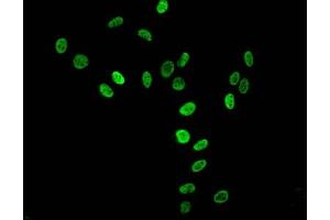 Immunofluorescent analysis of Hela cells using ABIN7139669 at dilution of 1:100 and Alexa Fluor 488-congugated AffiniPure Goat Anti-Rabbit IgG(H+L) (HIST1H3A 抗体  (3meLys36))