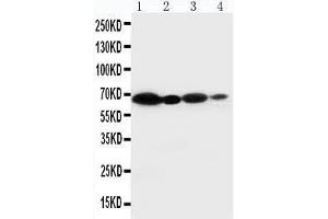 Anti-NOX2/gp91phox antibody, Western blotting Lane 1: HELA Cell Lysate Lane 2: JURKAT Cell Lysate Lane 3: MCF-7 Cell Lysate Lane 4: SMMC Cell Lysate (CYBB 抗体  (Middle Region))