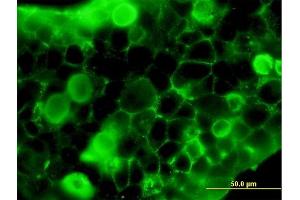 Immunofluorescence of purified MaxPab antibody to FLT1 on 293 cell. (FLT1 抗体  (AA 1-687))