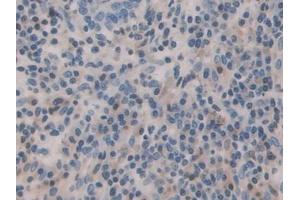 Immunohistochemistry (IHC) image for anti-Bone Morphogenetic Protein 15 (BMP15) (AA 266-388) antibody (ABIN7434677)
