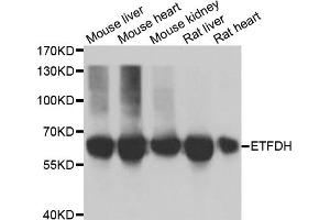 Western blot analysis of extracts of various cell lines, using ETFDH antibody. (ETFDH 抗体)