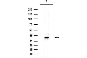 Western blot analysis of lysates from Rat testis, using HSD11B1 Mouse Monoclonal Antibody at 1/1000 dilution.
