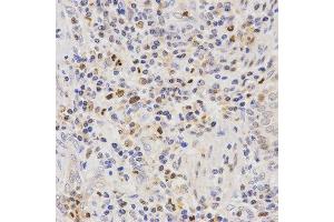 Immunohistochemistry (IHC) image for anti-Secretin Receptor (SCTR) antibody (ABIN3017416) (SCTR 抗体)